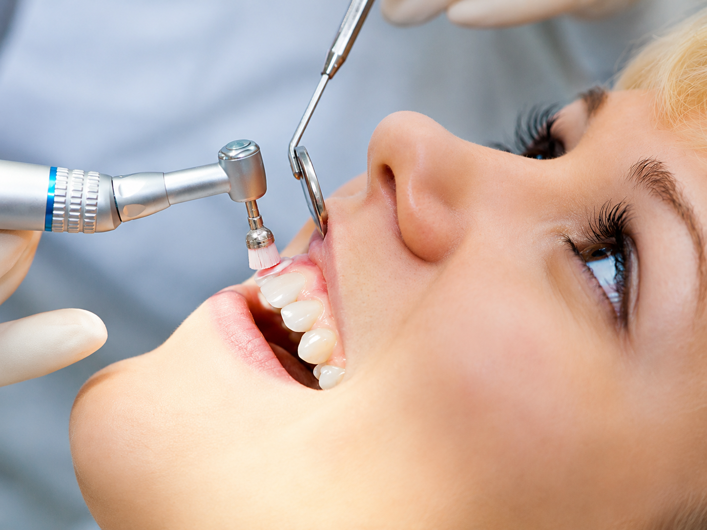 Dental Cleaning